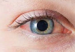 Home Remedies for Blood Shot eyes