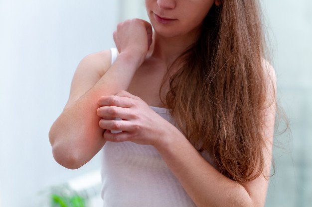 how-to-stop-itching-skin-in-eczema-home-remedies