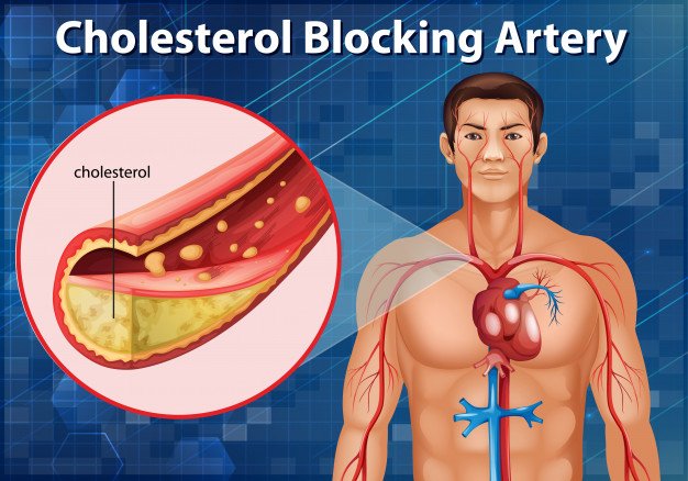 Turmeric helps decrease in cholesterol